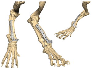 Examples of computer-modeled custom implants