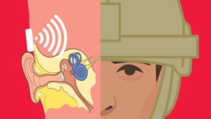 Cartoon of a person with half of the face replaced with hearing aid diagram. 