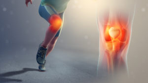 an animated image of a runner mid-stride with the pain region for patellofemoral pain syndrome highlighted