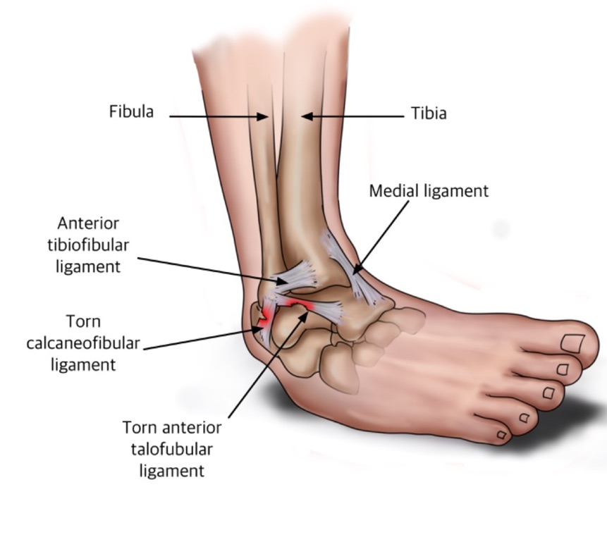 ligaments-biomechanics-in-the-wild