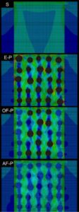 Images of stress concentrations in and around a solid titanium implant and porous titanium implants with various levels of bone ingrowth