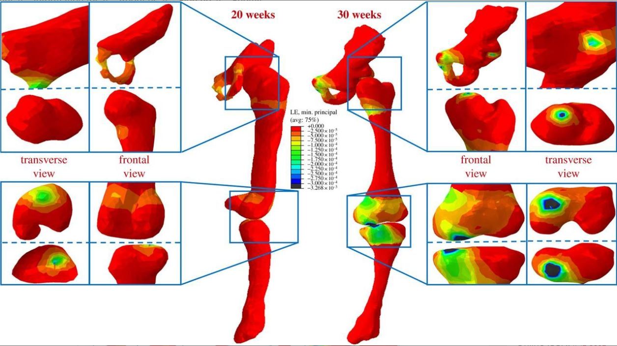 simulated strain concentrations in a fetal leg