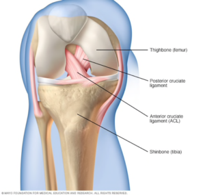 A photo showing the location of the PCL and ACL inside of the right knee. The ACL crosses from left to right over the PCL. Both are attached at the top to the femur and at the bottom to the tibia.