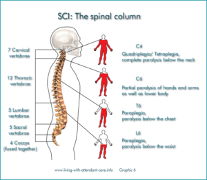 Image showing the area of injury corresponding to the resulting level of paralysis 