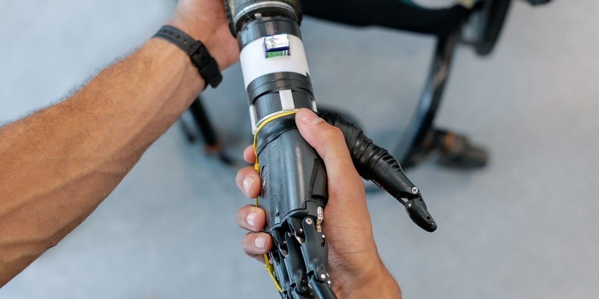 Advances In Prostheses: Restoring the Sense of touch to amputees