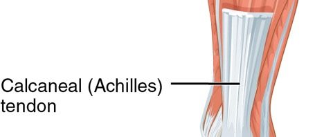 An Achilles tendon attached to the heel and calf (Soleus)