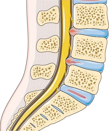 Pressurized Vessels Supporting the Spine: Structure and Function of ...