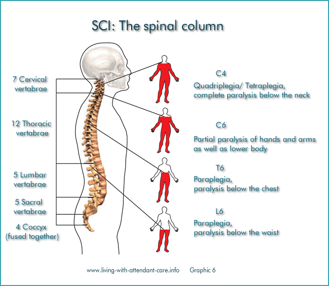 medical-marvel-robotic-exoskeletons-enable-those-with-spinal-cord