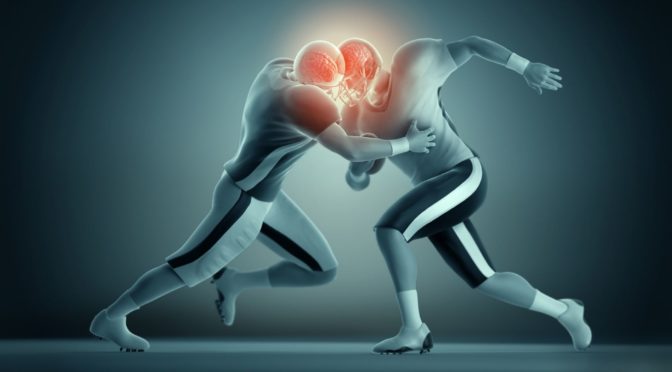 The Dangers of Using Your Head: The Biomechanics of Sports-Related Concussions