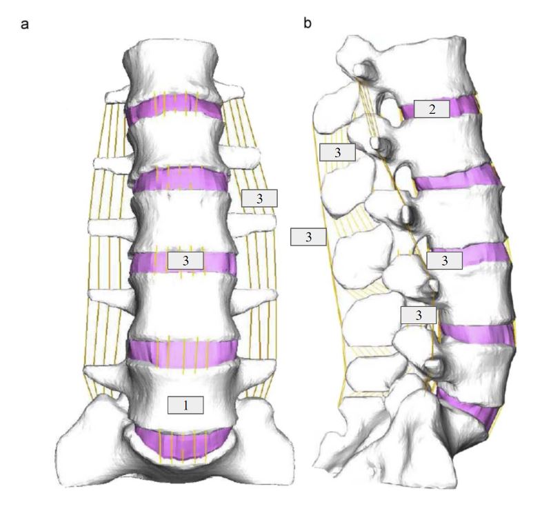This is a model of the spine used in the computer model, labeled with the bone, ligaments, and intervertebral material