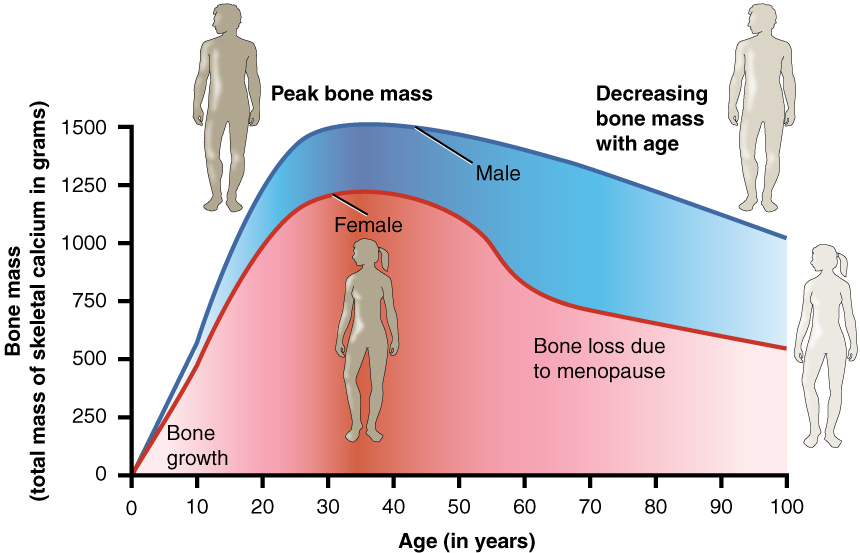 Graph of the bone mass as a function of age for males and females. The peak bone mass is highlighted and the image depicts a decreasing bone mass with age. 