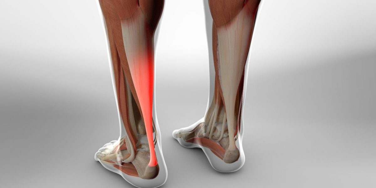 Image of back leg with Achilles Tendon highlighted