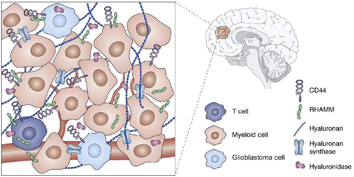 Sensing tension in the brain tumor microenvironment