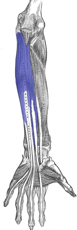 An image of the muscles and tendons in the forearm and hand. The four flexor digitorum profundus tendons are distinct, running individually along each finger, but they are seen coalescing into the one common muscle belly which is highlighted.