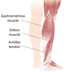 Diagram of leg with gastrocnemius muscle, soleus muscle, and Achilles tendon labeled