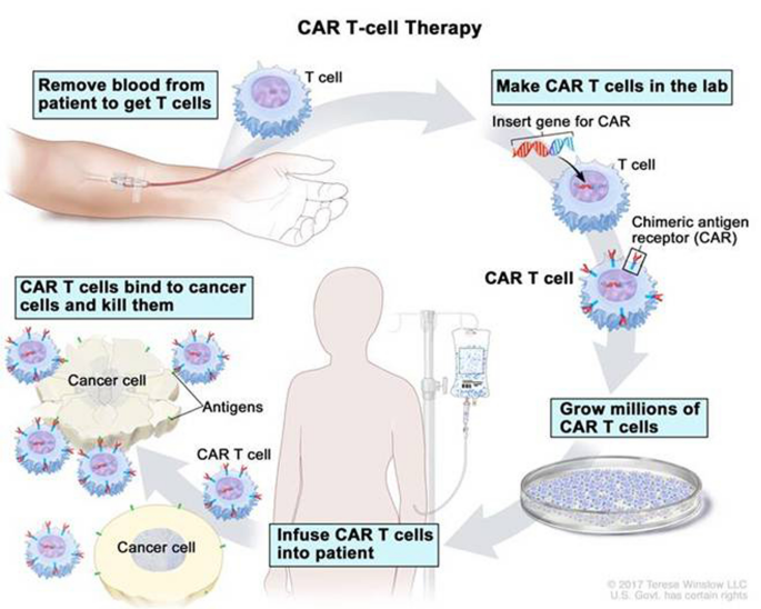 This image depicts the process of generating CAR T cells in a step by step manner. 