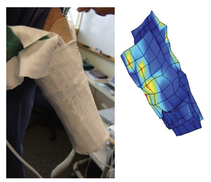 The image on the left shows an upper-limb prosthesis socket with pressure sensors. The image on the right shows a 3D representation of the pressure map for this limb.