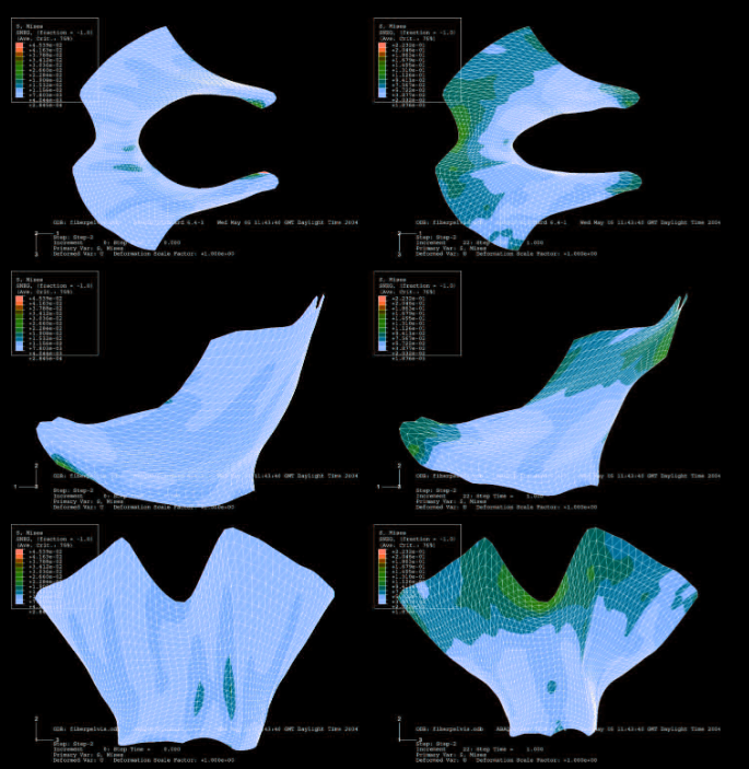 Computer simulation models of the levator ani muscle. This muscle is similar looking to a wishbone, with two protruding muscles upward and one downward, like a letter Y. On the right shows only light blue and blue colors on the muscle, indicating no strain. On the right shows darker green and blue highlights on the two protruding upwards direction, indicating strain and stress. 