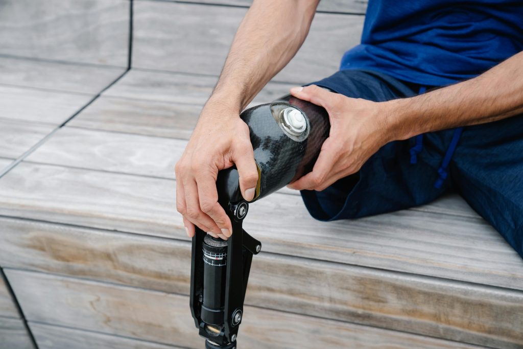 Man sitting on bench with hands around the thigh of his prosthetic leg.