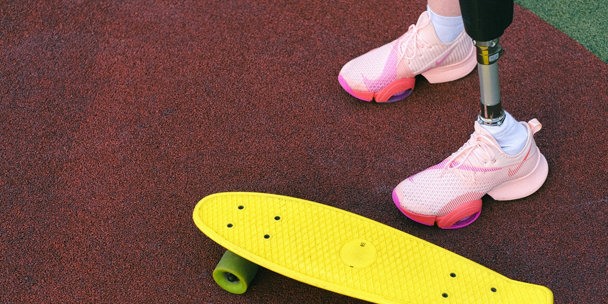 Legs with one prosthesis in pink shoes by yellow skateboard.