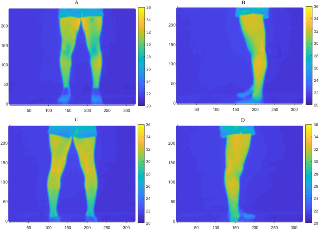 Sample thermal images of the lower body in the anterior (upper left), left lateral (upper right), posterior (lower left), and right lateral (lower right) views.